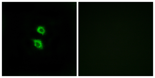 Arylsulfatase D Ab