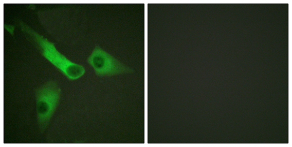 p-Caspase 9 (Y153) Ab