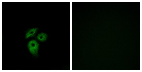 Atypical chemokine receptor 1 Ab