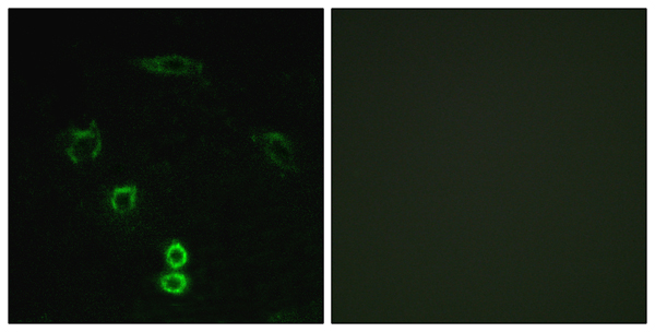 Glycerate kinase Ab