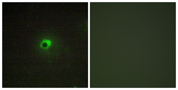 Activin receptor type 1C Ab