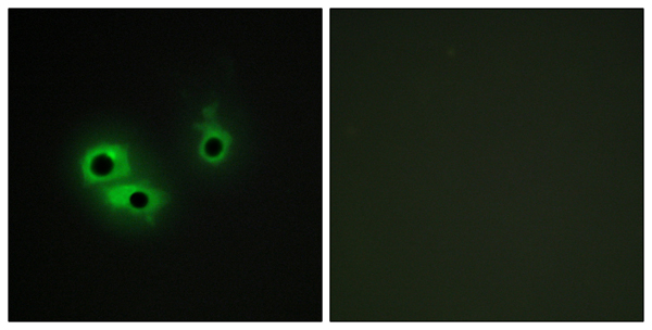 Anterior gradient protein 3 Ab