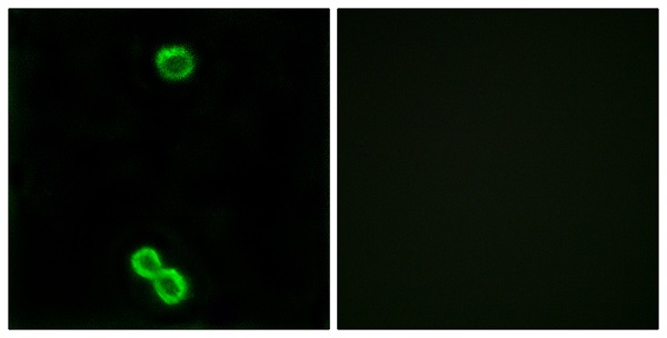 Ribosomal protein uL3 like Ab