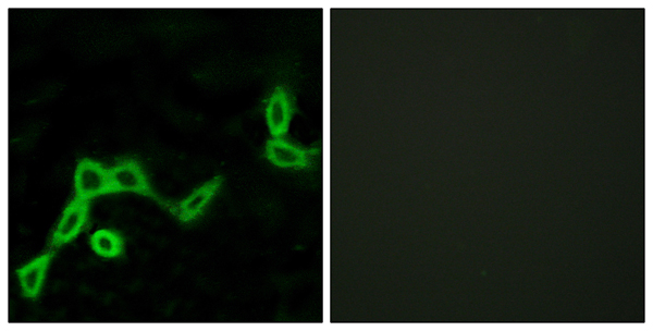 KiSS 1 receptor Ab