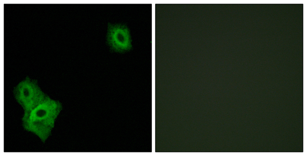 Apoptosis inducing factor 3 Ab