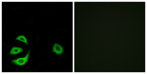 Acyl CoA thioesterase 8 Ab