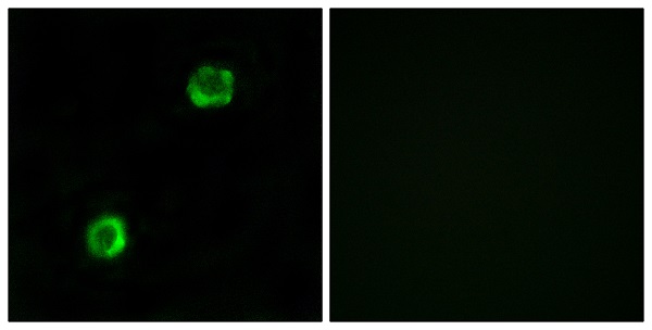 Apolipoprotein L2 Ab