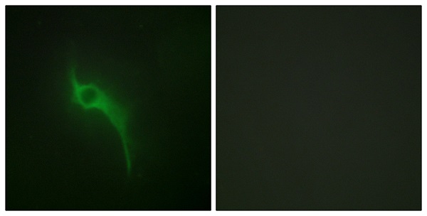 Collagen V alpha 1 Ab