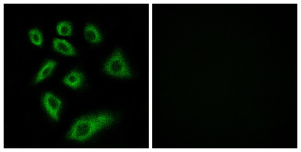 Cytochrome P450 2W1 Ab