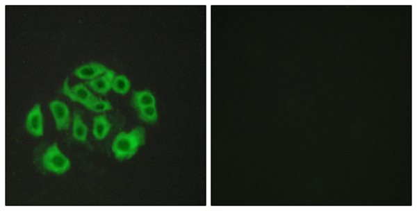 Endomucin Ab