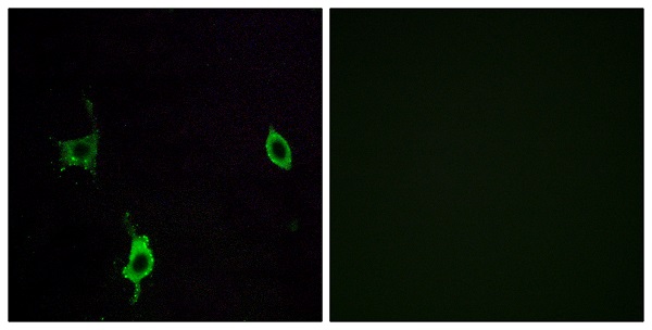 Laminin gamma 3 Ab