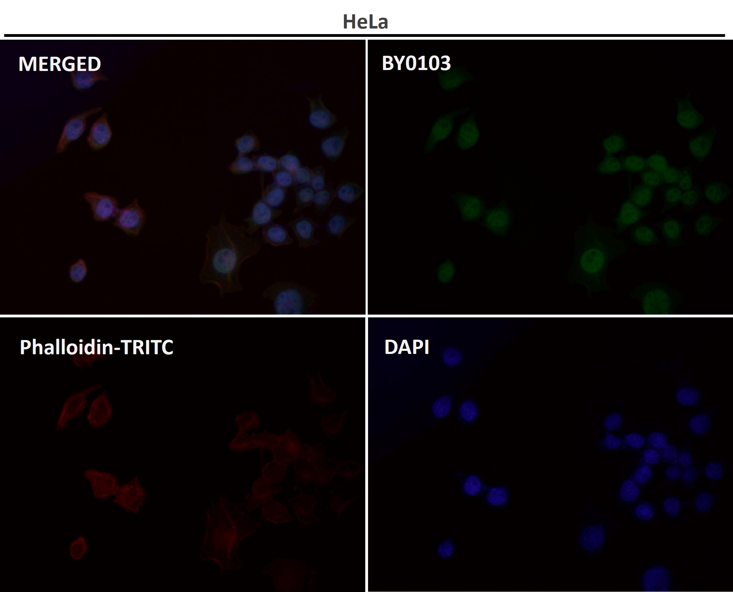 Collagen II alpha 1 Ab