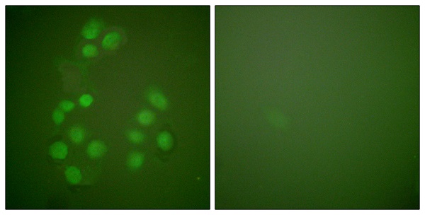 CREB binding protein Ab