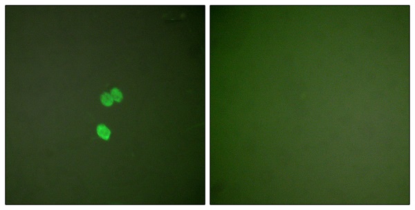 Galectin 3 Ab