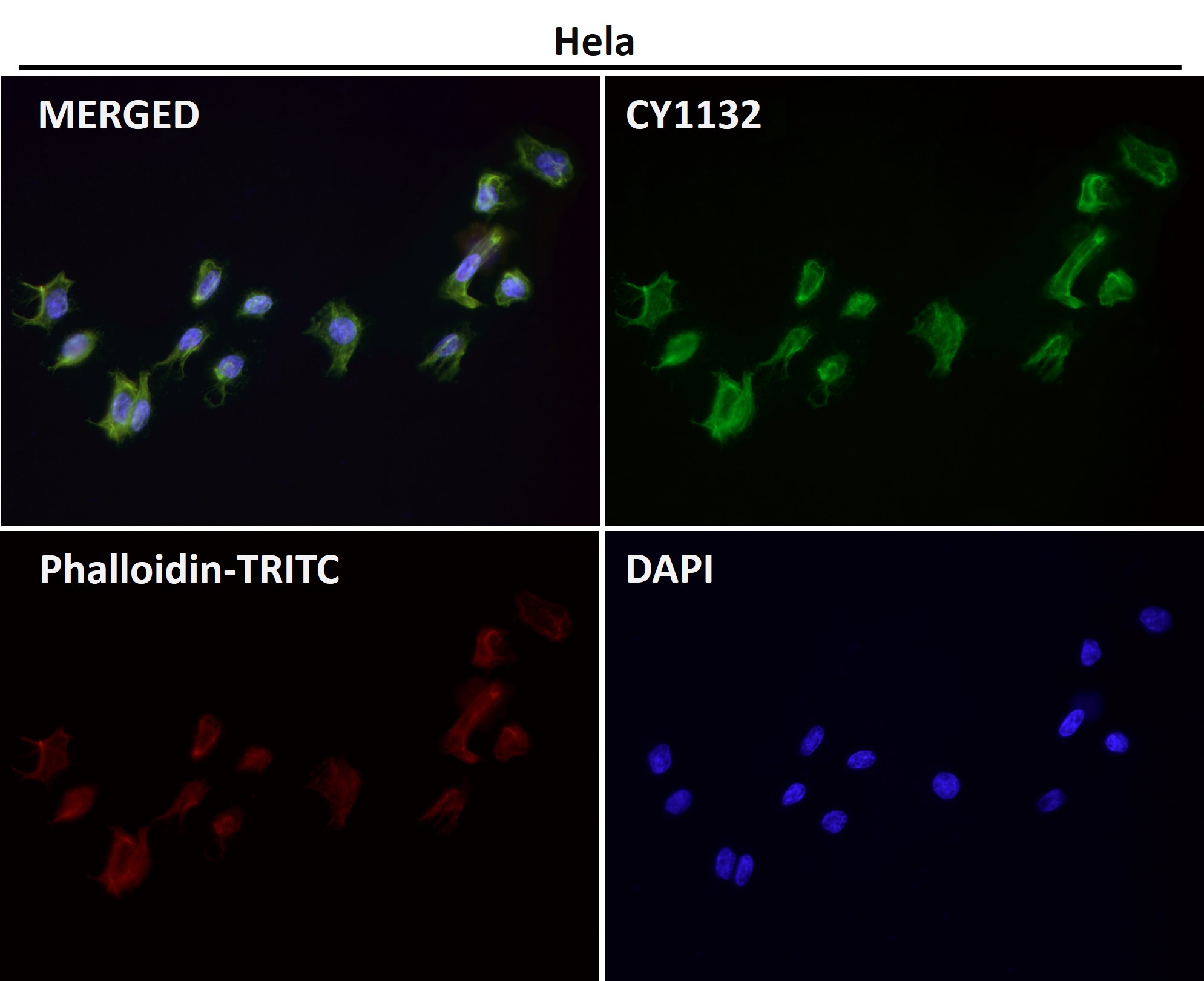 alpha Smooth muscle actin Ab