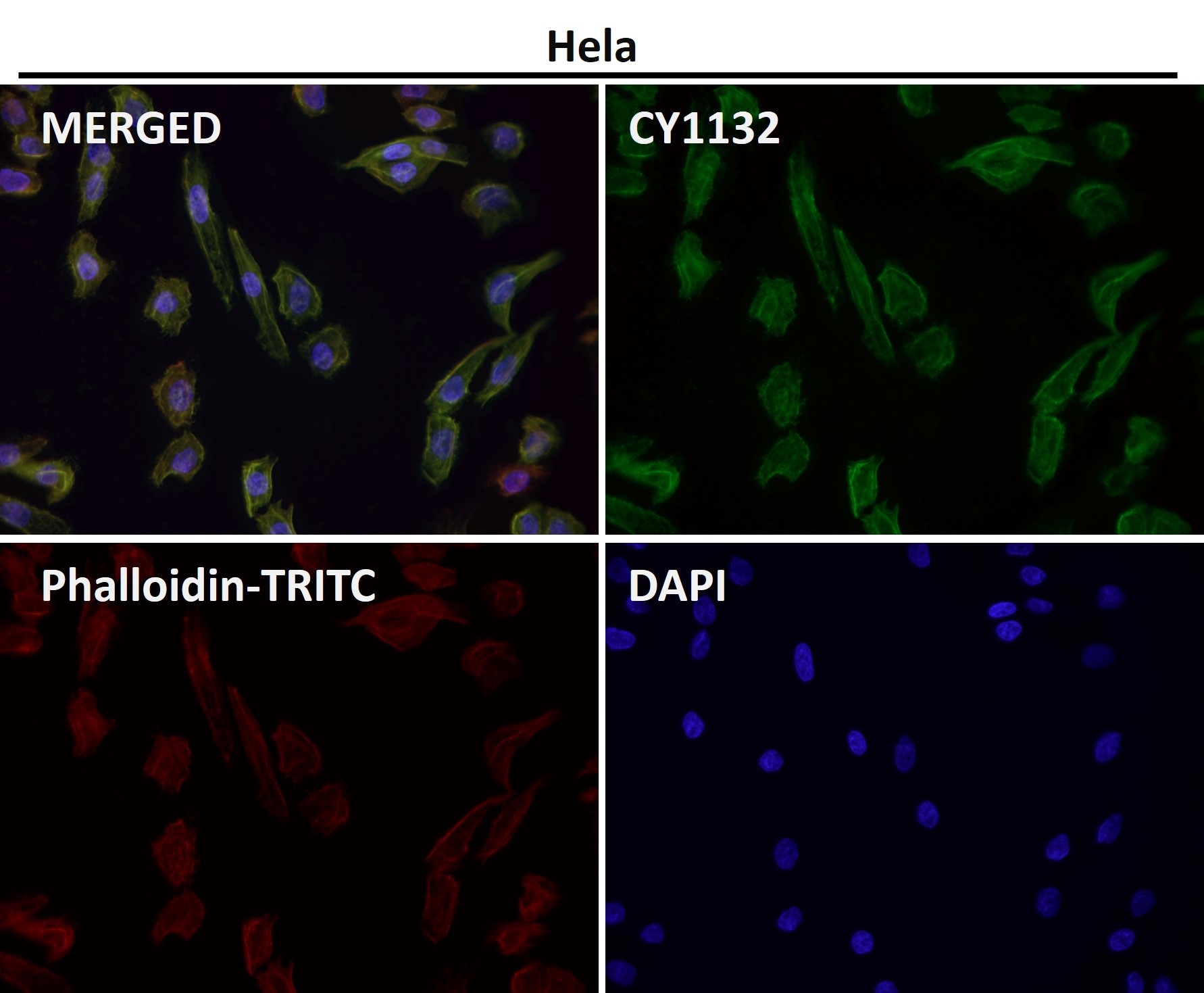 alpha Smooth muscle actin Ab