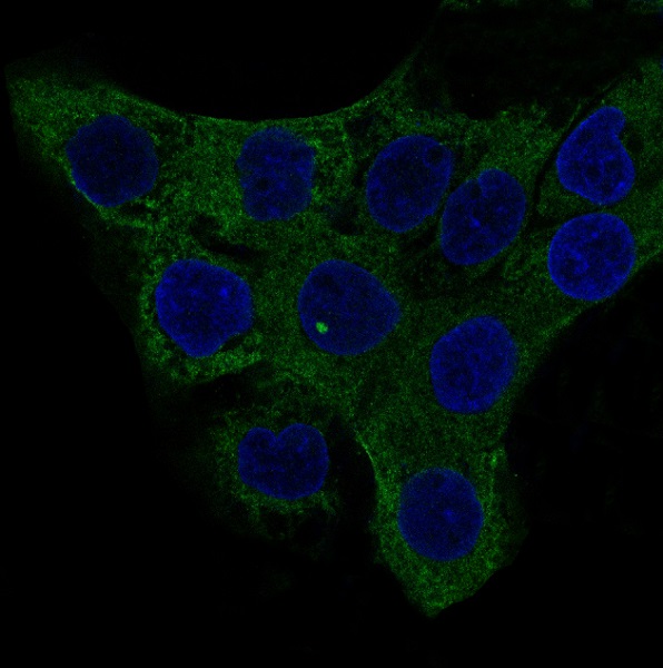 alpha Smooth muscle actin Ab