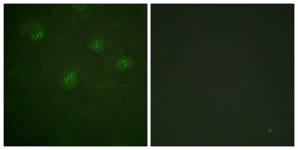 Estrogen receptor Ab