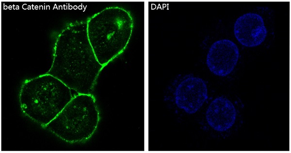 beta Catenin Ab