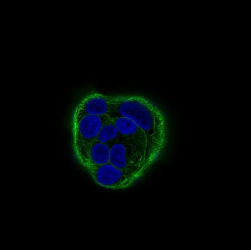 Cytokeratin 18 Ab