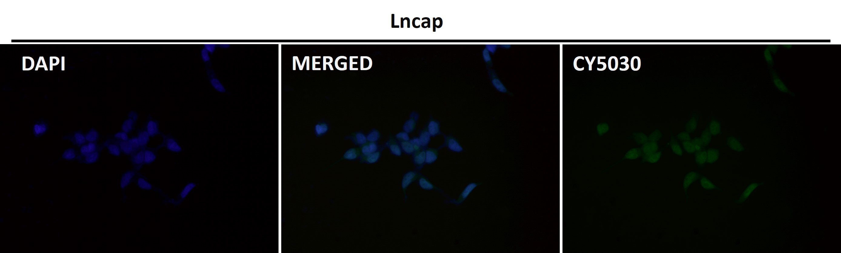 Androgen receptor Ab