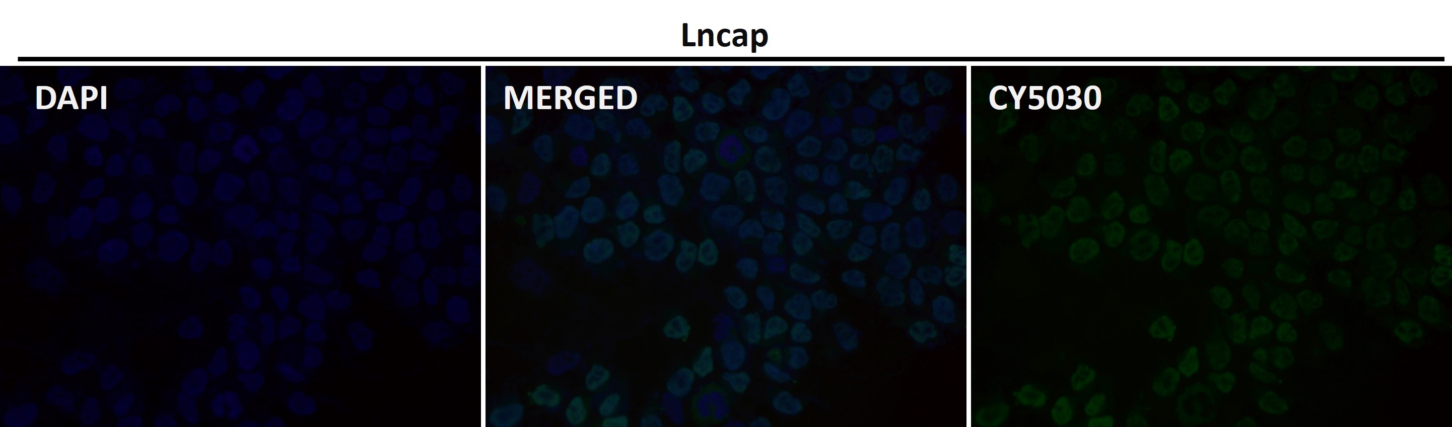 Androgen receptor Ab