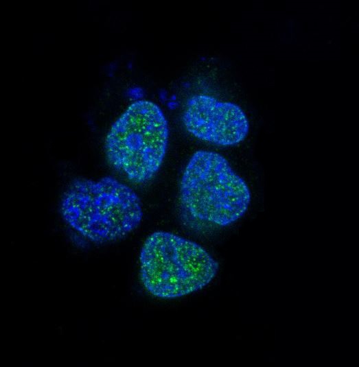 Androgen receptor Ab