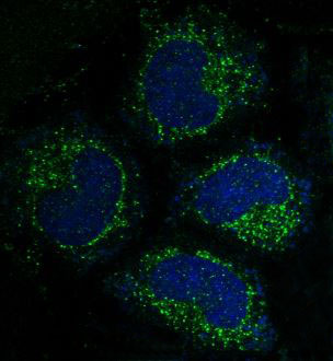 Caspase 3 Ab