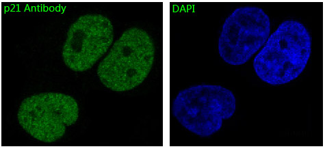 p21 CDKN1A Ab