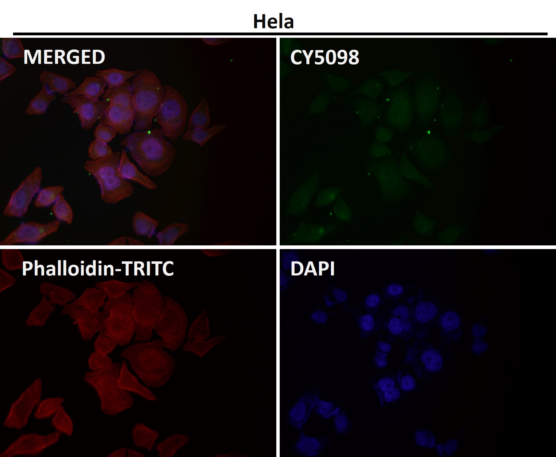 HIF 2 alpha Ab