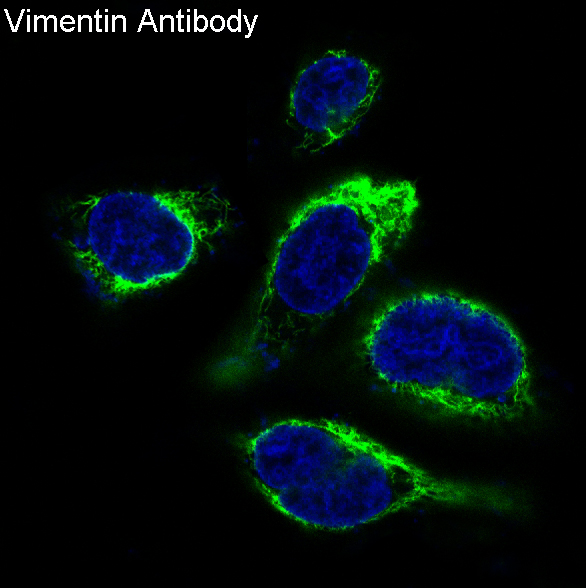 Vimentin Ab