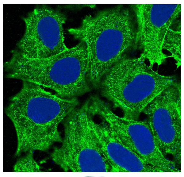 alpha Skeletal muscle actin Ab