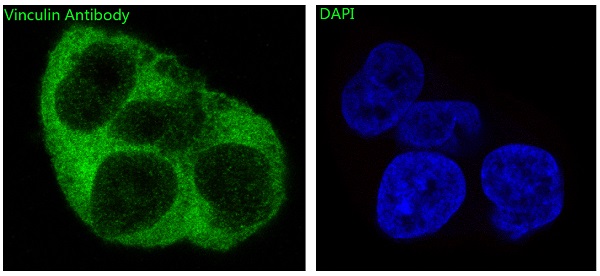 Vinculin Ab