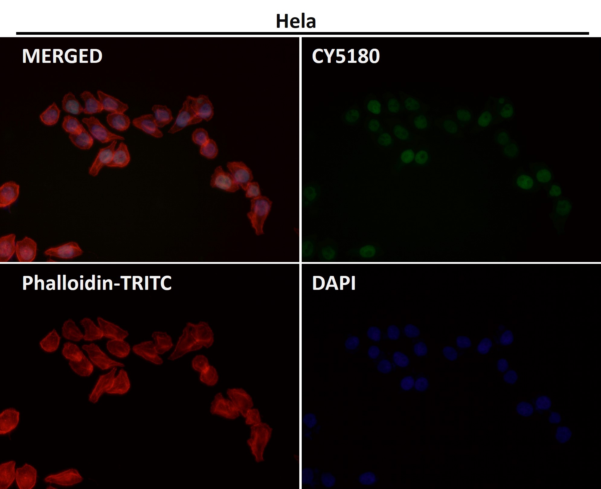 Acetyl-Histone H3 (K57) Ab