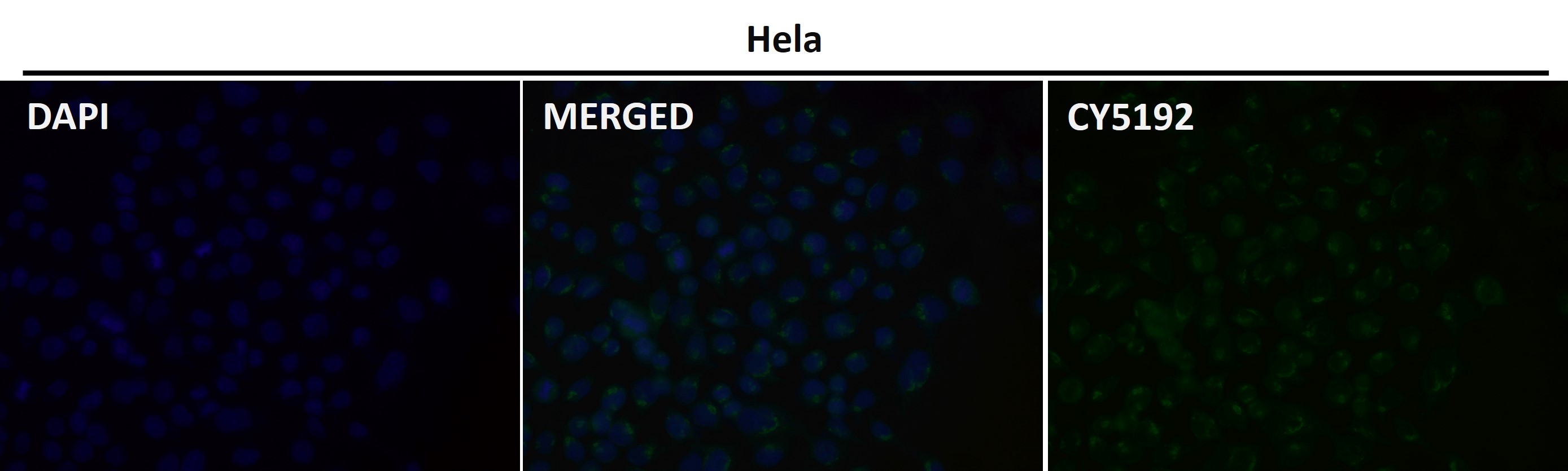 Glutamate carboxypeptidase 2 Ab