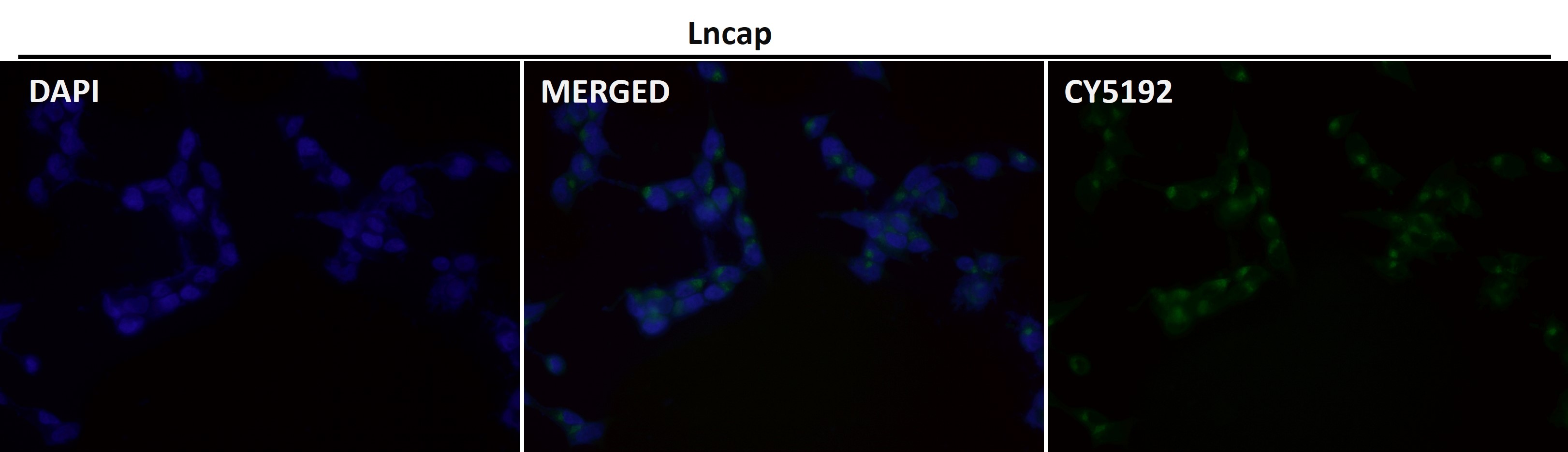 Glutamate carboxypeptidase 2 Ab