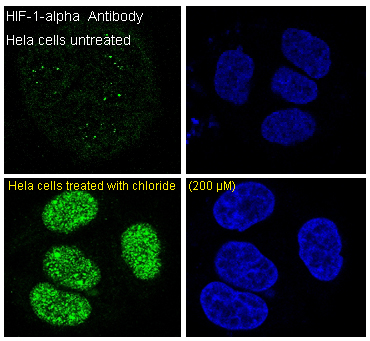 HIF 1 alpha Ab