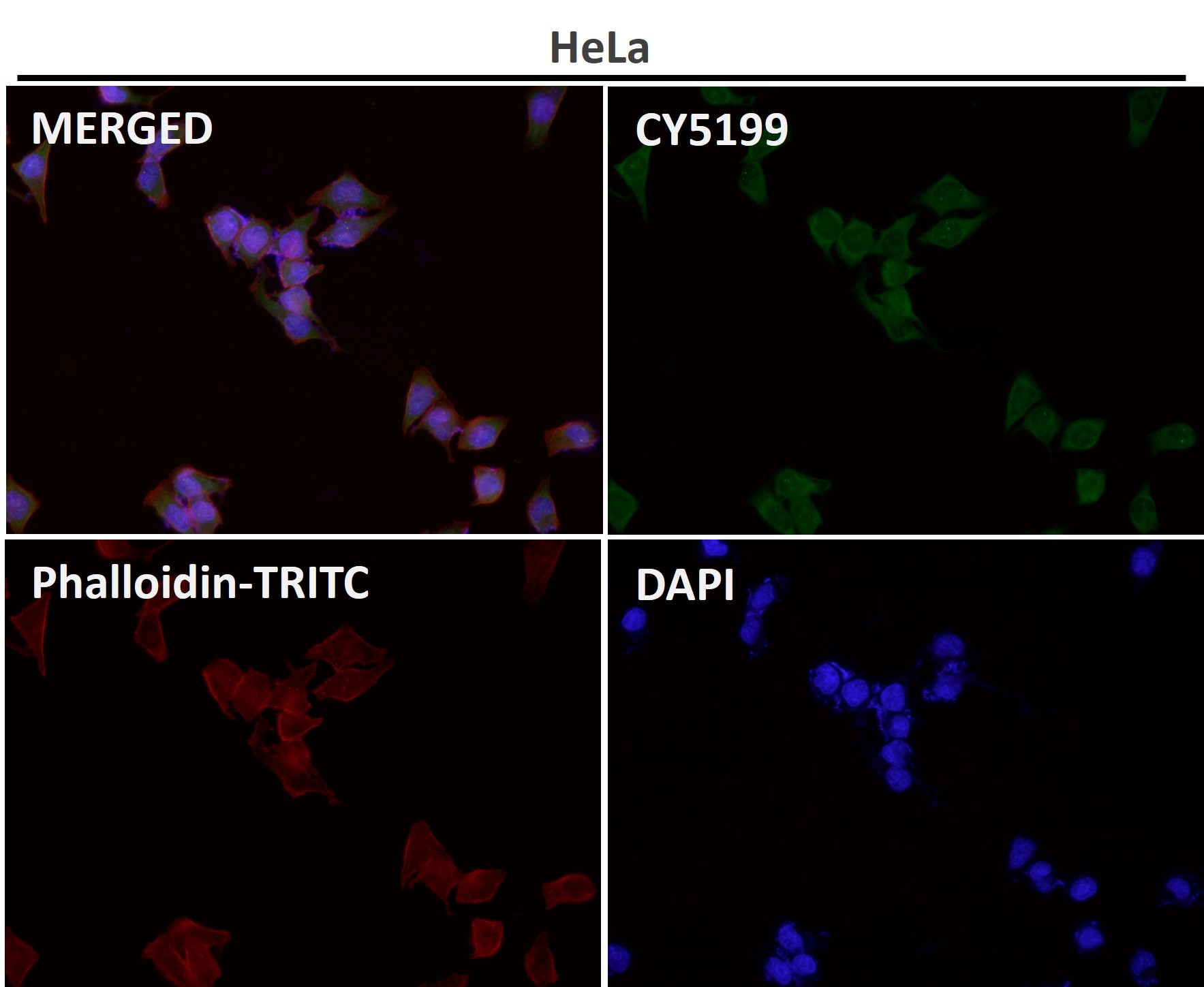 MCL1 Ab