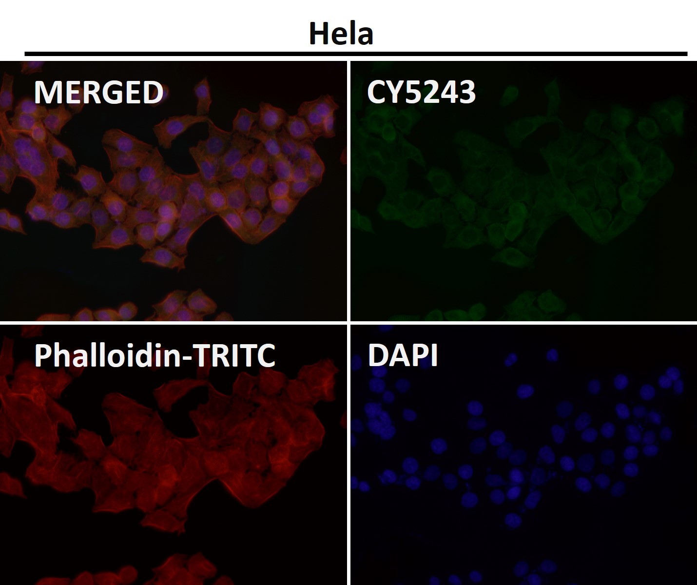 Neuropilin 1 Ab