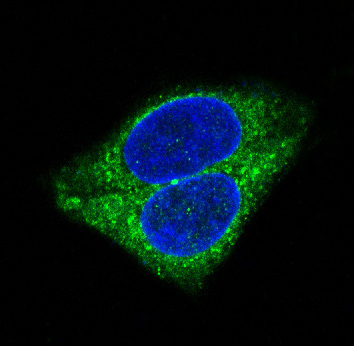 Synaptophysin Ab