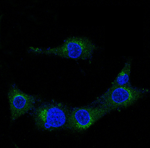 Amyloid beta A4 Ab