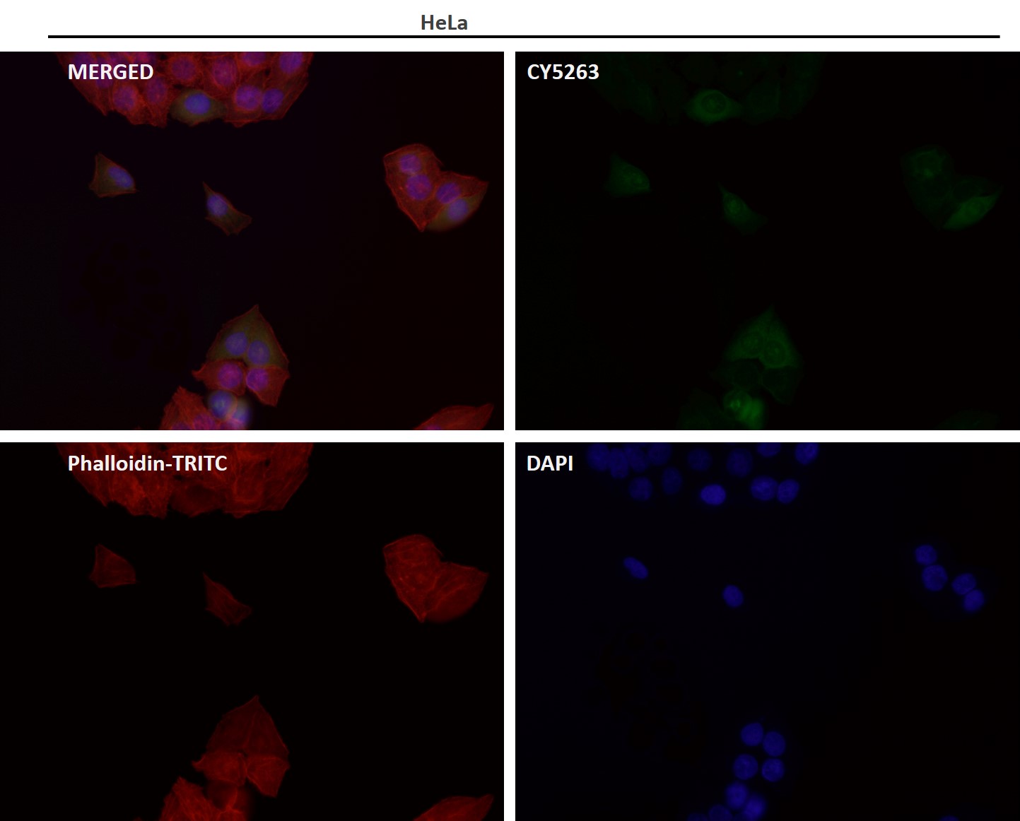 APAF 1 Ab