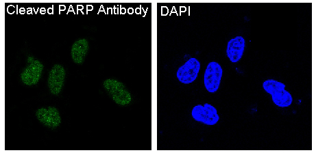 Cleaved-PARP 1 (D214) Ab