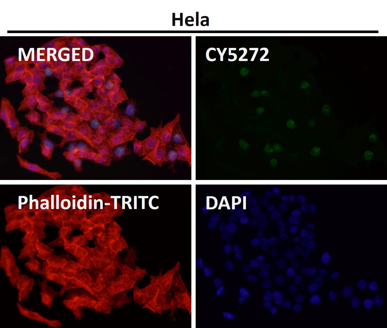 Acetyl-Histone H3 (K15) Ab