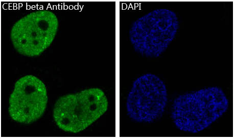 CEBP beta Ab