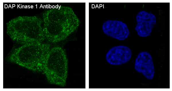 DAP kinase 1 Ab