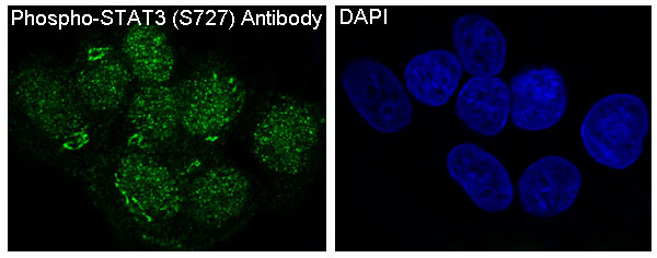 p-STAT3 (S727) Ab