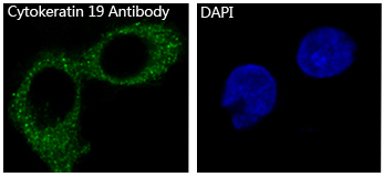 Cytokeratin 19 Ab