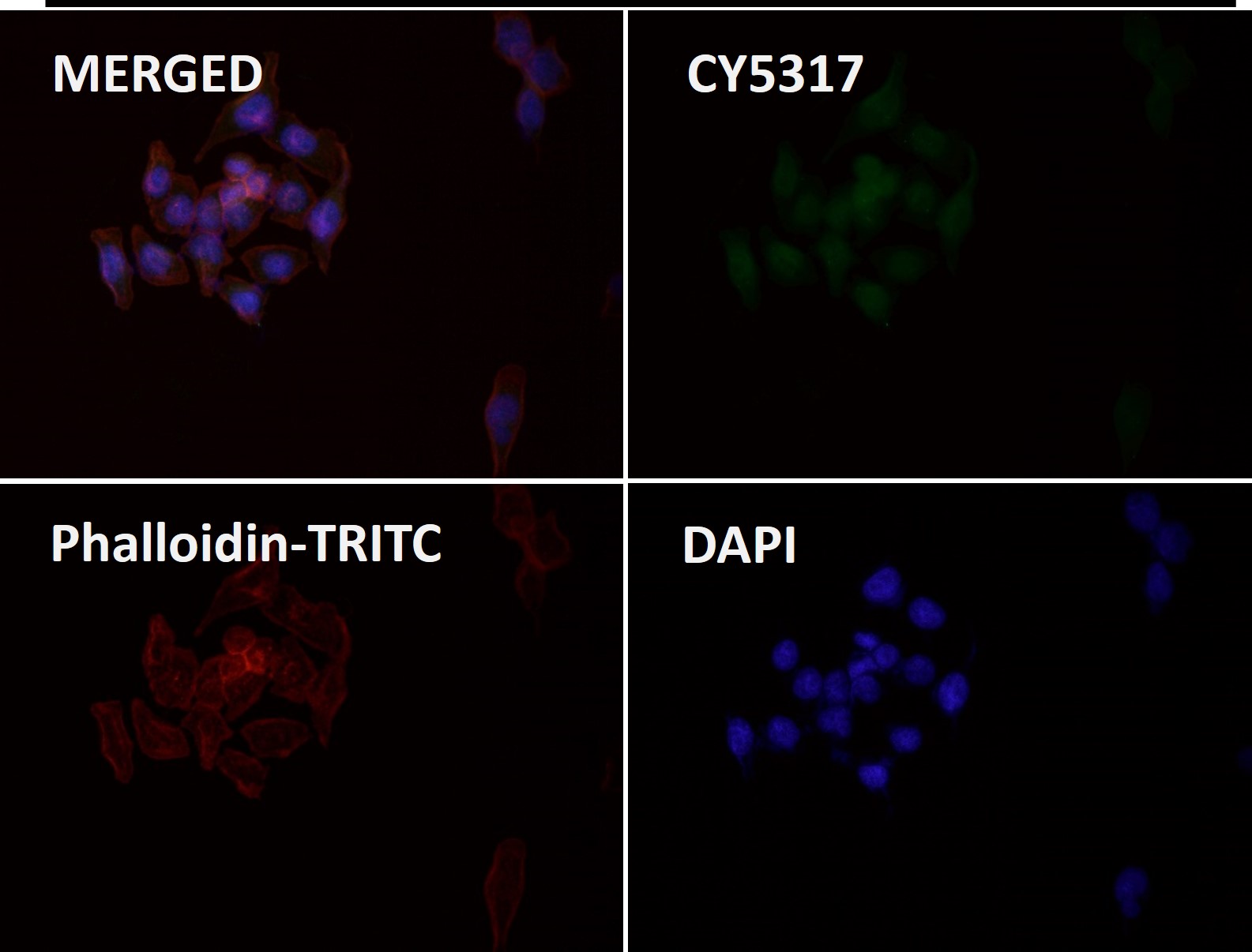 Integrin alpha V Ab