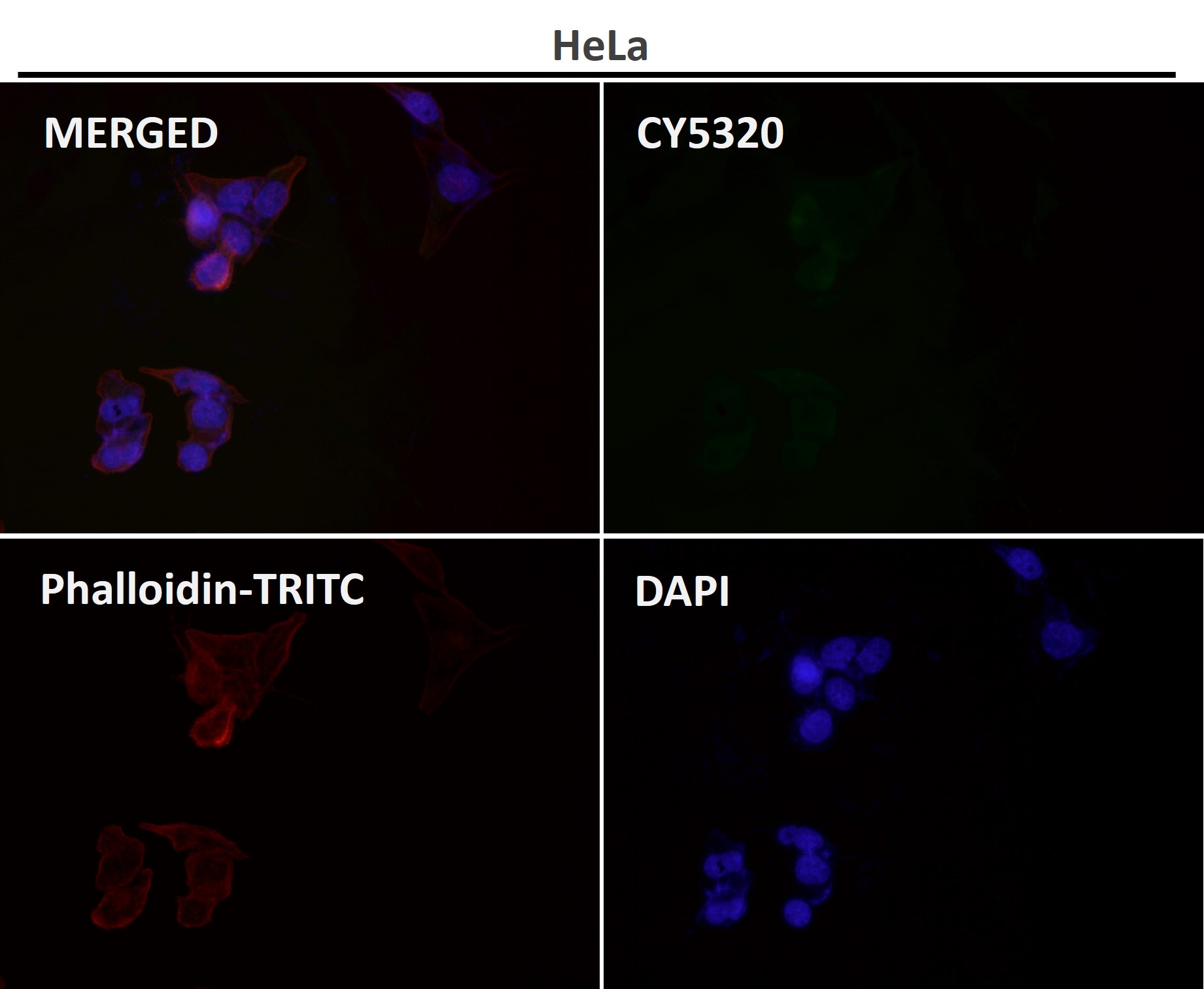 Glutamine synthetase Ab